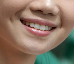 成人牙齿矫正注意事项 牙齿整齐更健康(图)